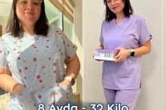 2023_01_00_fatih_erol_before_after1