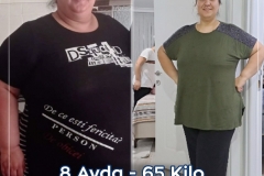 2023_03_00_fatih_erol_before_after