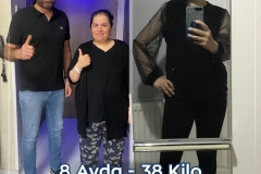 2023_03_00_fatih_erol_before_after2