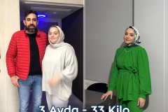 2023_03_00_fatih_erol_before_after3