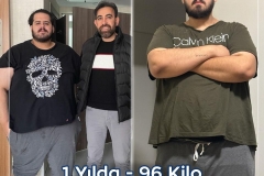 2023_04_00_fatih_erol_before_after
