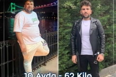 2023_05_00_fatih_erol_before_after-kopyasi