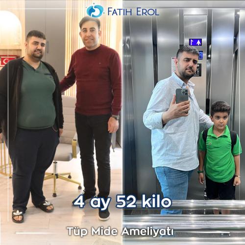 2022 08 00 fatih erol before after2 3