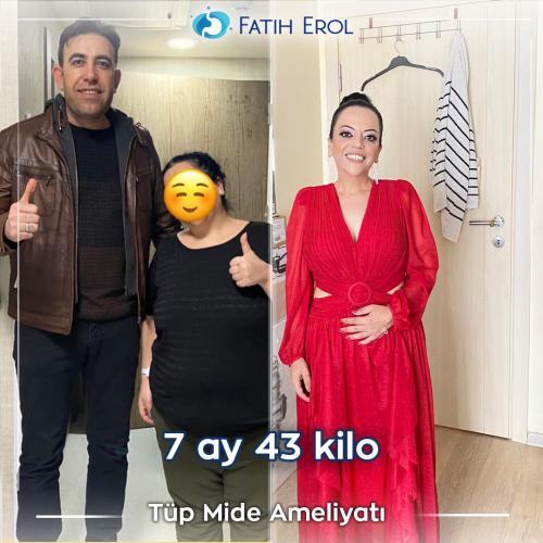 2022 09 00 fatih erol before after 5