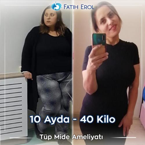 2022 12 00 fatih erol before after1