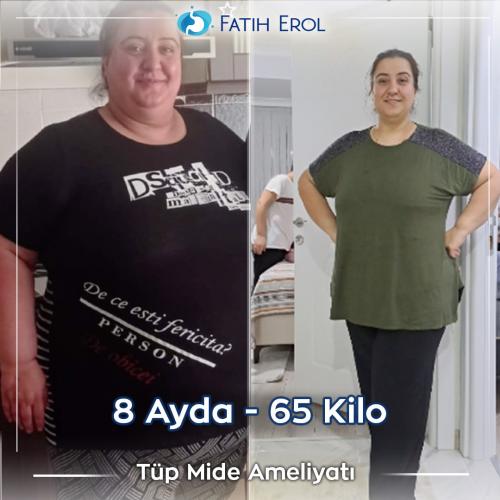 2023 03 00 fatih erol before after
