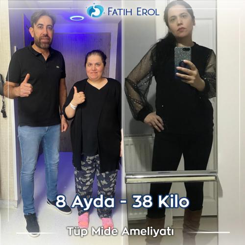 2023 03 00 fatih erol before after2