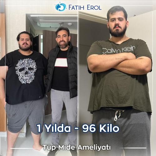 2023 04 00 fatih erol before after