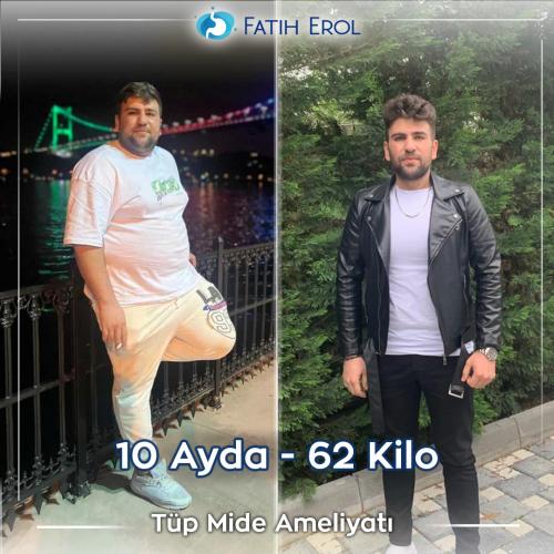 after-before.33