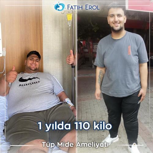 after-before.31