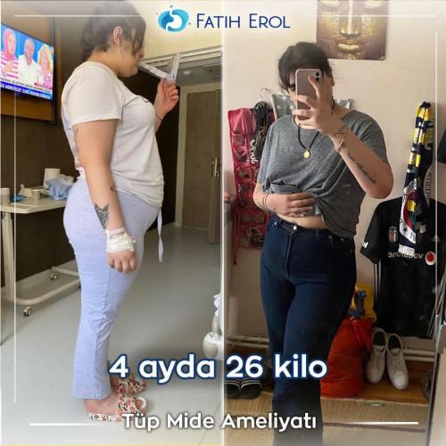 after-before.34